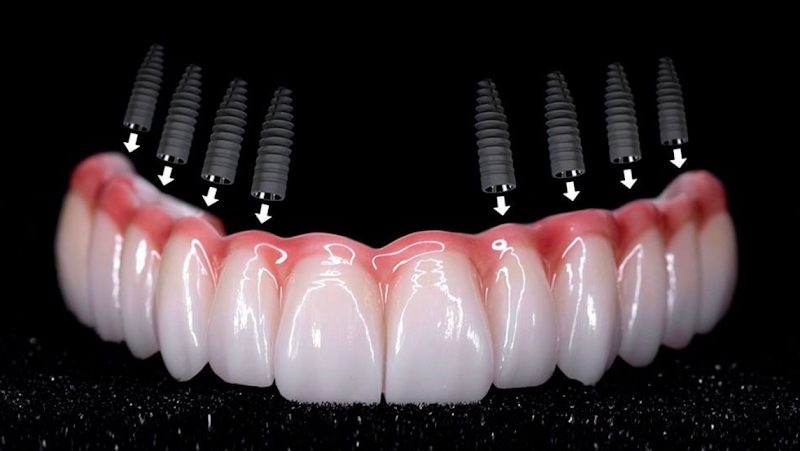 Foto 2 de Dr. Rodolfo Bendoraytes - Dentista Implantes Dentários e Prótese Dentária Recreio dos Bandeirantes