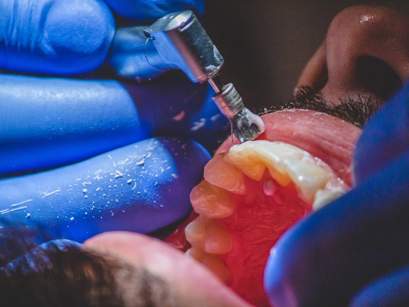 Foto 7 de DR. RODRIGO ALBAREZ | Cirurgião Dentista no Sion - BH