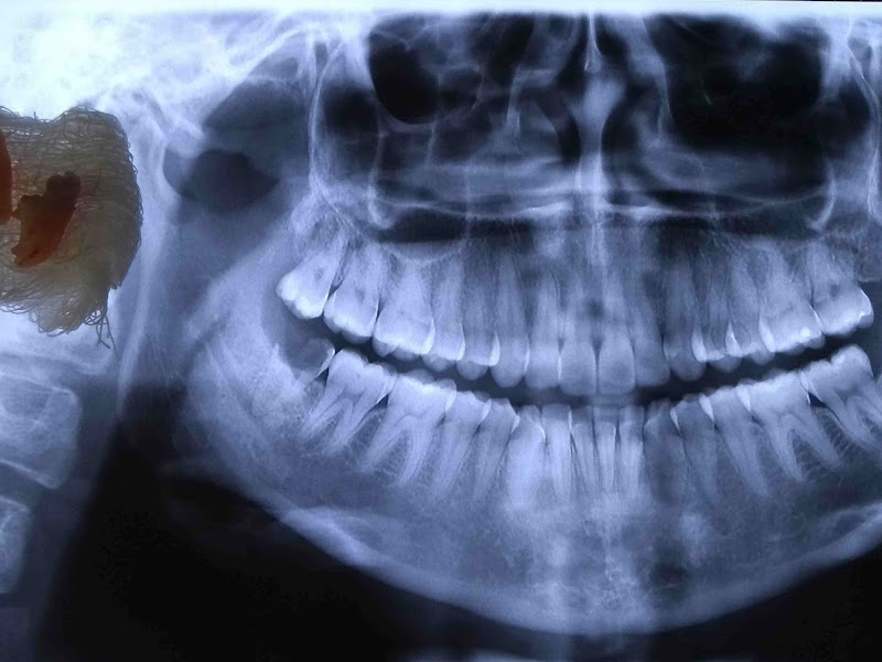Foto de Dr. Rodrigo Bormio e Dra. Verena Vieira