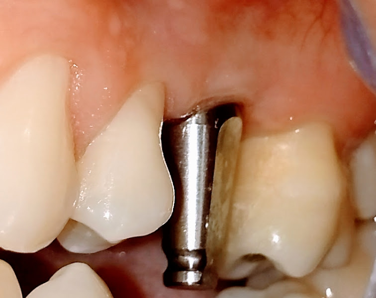 Foto 3 de Dr. Rodrigo Bormio e Dra. Verena Vieira