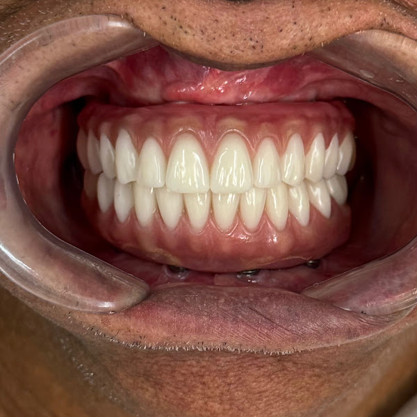 Foto 3 de Dr. Rodrigo Laguardia - Consultório Odontológico - Implante Dentário