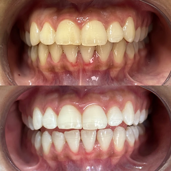 Foto 2 de Dr. Rodrigo Lima | Cirurgião Dentista | Lima Odontologia Estética