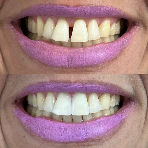 Foto 3 de Dr. Rodrigo Lima | Cirurgião Dentista | Lima Odontologia Estética