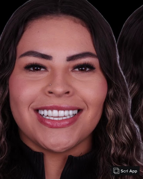 Foto 3 de Dr. Rodrigo Moro - São José dos Pinhais | Lentes Dentais | Implantes | Clínico geral