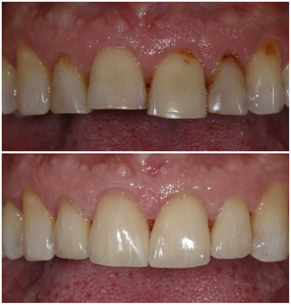 Foto 3 de Dr. Rodrigo Pohlmann - Estética Dental