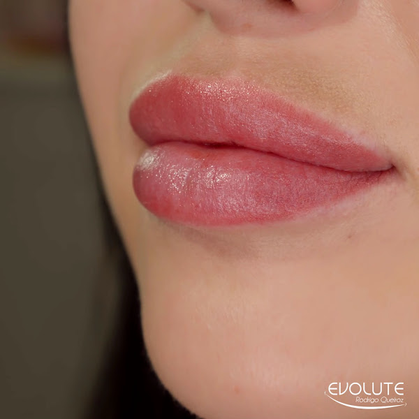 Foto 3 de Dr. Rodrigo Queiroz - Clínica Evolute