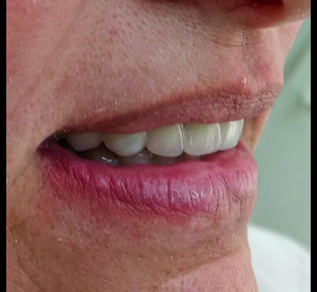 Foto 3 de Dr. Rodrigo Sorato - Implantes Dentários em Criciúma