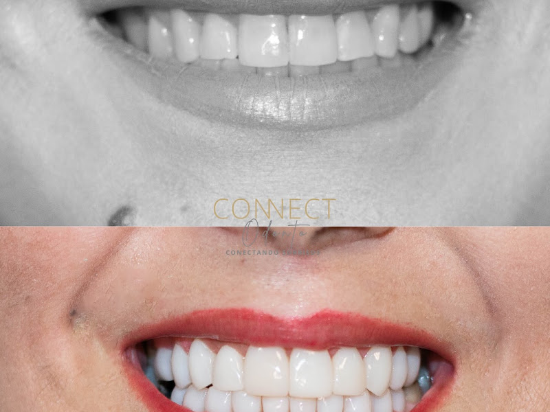 Foto 13 de Dr. Roger Hurtado Dentista Curitiba | Hurtado Dental Prîme