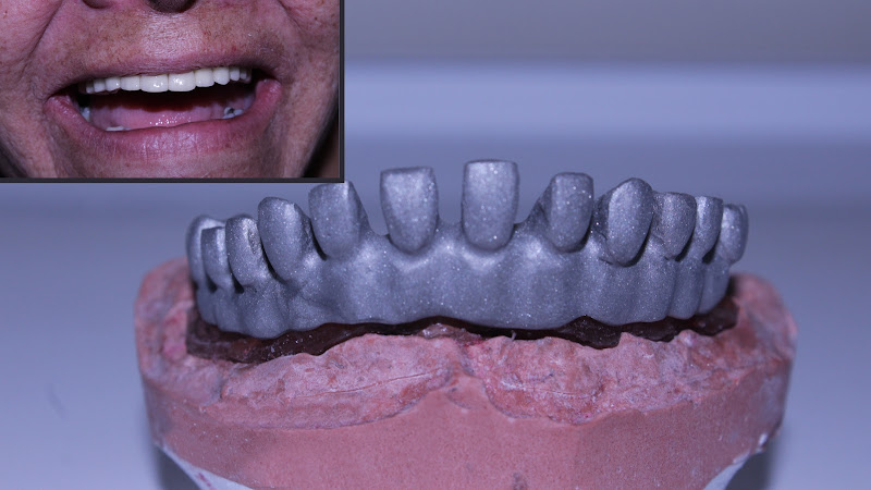 Foto 2 de Dr. Rogério Barboza Vaz - Lentes, facetas e implantes dentários