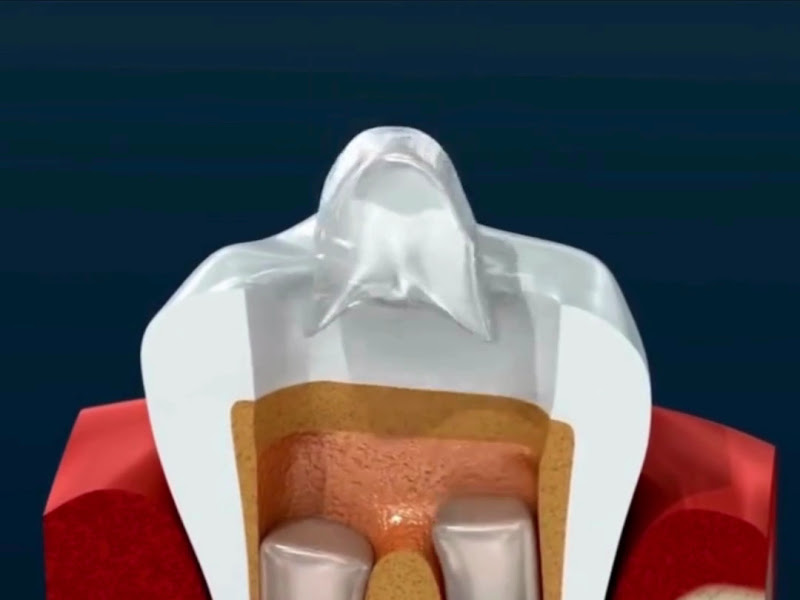 Foto de Dr Rogério Soares Consultório Odontológico - Especialista em Canal - Parnaíba PI