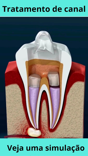 Foto 2 de Dr Rogério Soares Consultório Odontológico - Especialista em Canal - Parnaíba PI