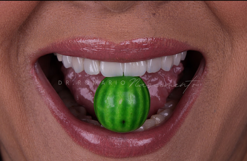 Foto 2 de Dr Romario Nascimento Odontologia Estética