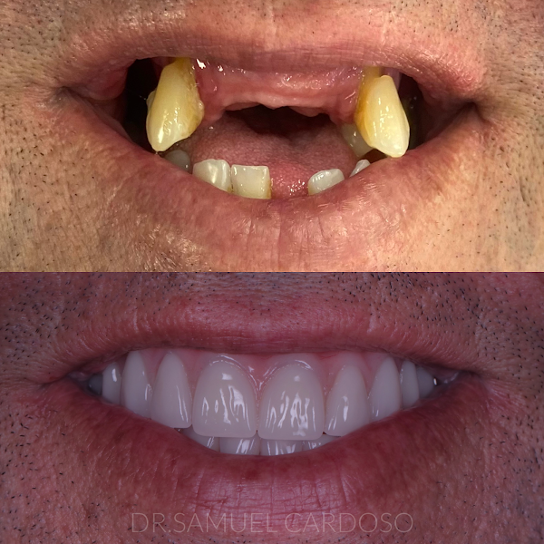 Foto 2 de Dr. Samuel Cardoso - Odontologia SP