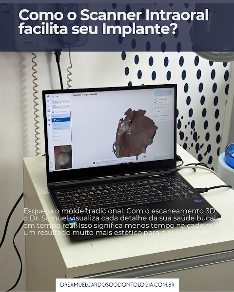 Foto 3 de Dr. Samuel Cardoso - Odontologia SP