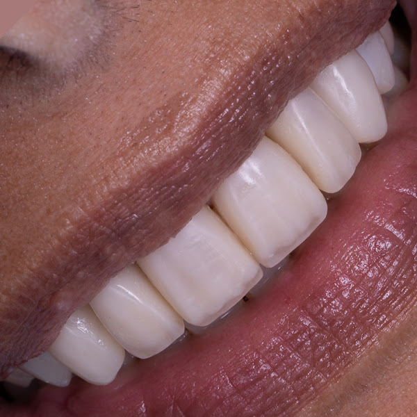 Foto 5 de Dr. Samuel Cardoso - Odontologia SP