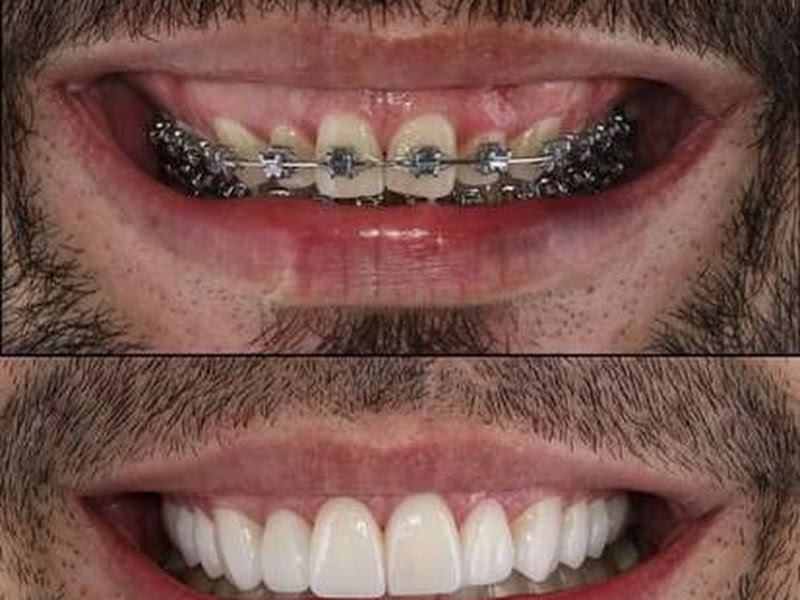 Foto 3 de Dr Samy Caio Consultório Odontológico (DENTISTA)