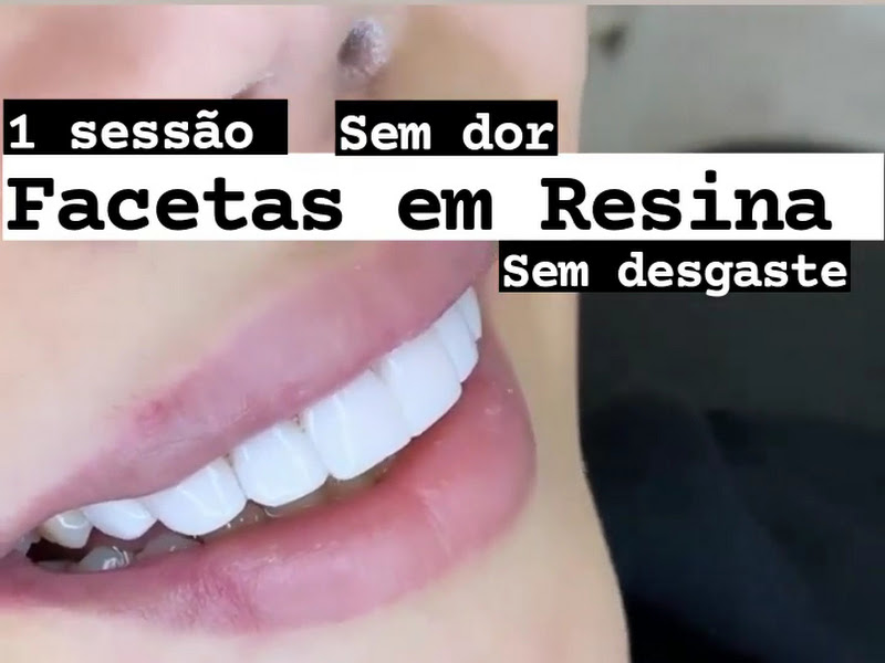 Foto 7 de Dr. Samy Caio Consultório Odontológico (DENTISTA)