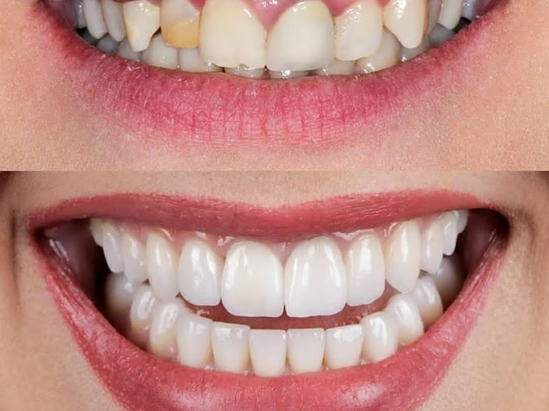 Foto 6 de DR. Saúde Eldorado | Dentista | Implante Dentário | Eldorado | São José do Rio Preto - SP