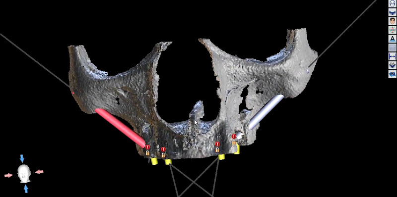 Foto 3 de Dr. Saulo Ferraz - Bucomaxilo, Implantodontia e Ortodontia
