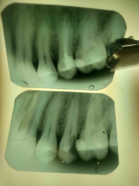 Foto 3 de Dr. Saulo Lacerda Odontologia