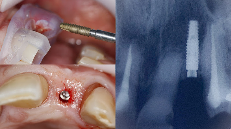 Foto 3 de Dr. Saulo Sá - Reabilitador Oral