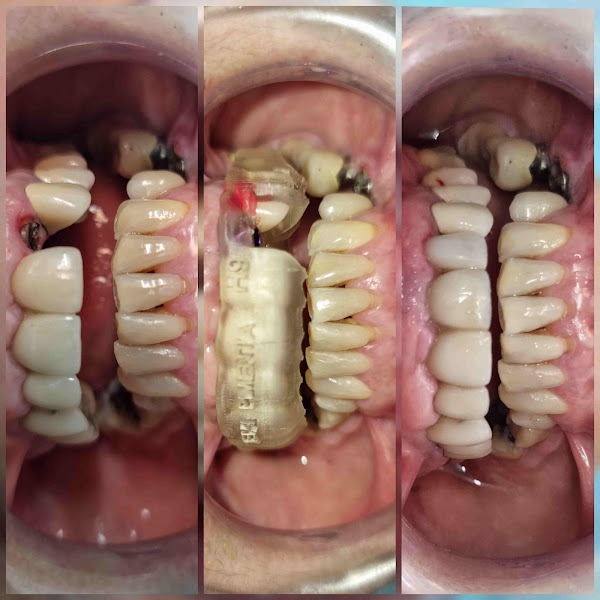 Foto 5 de Dr. Saulo Sá - Reabilitador Oral