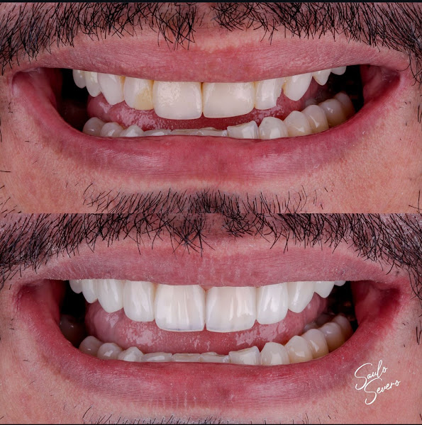 Foto 3 de Dr. Saulo Severo Odontologia