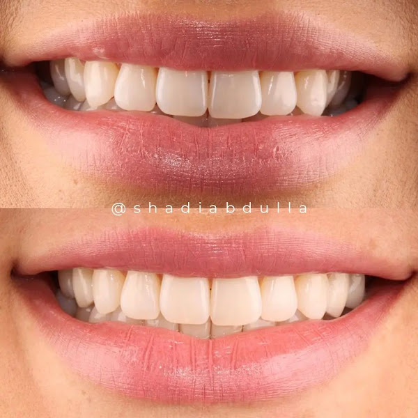 Foto 2 de Dr. Shadi Abdulla