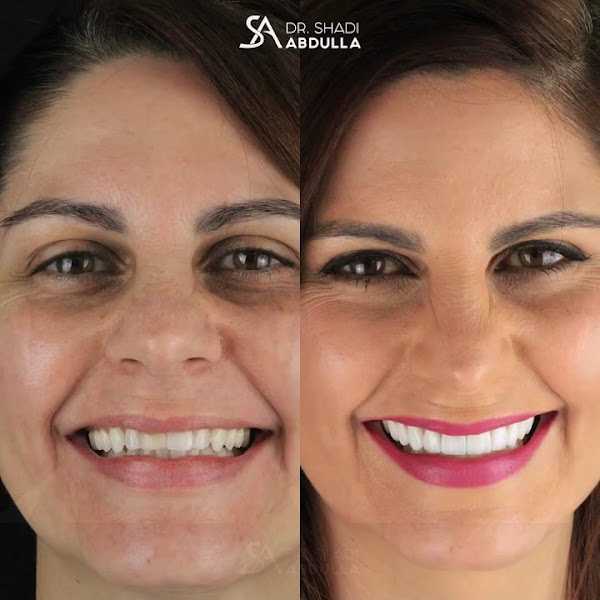 Foto 3 de Dr. Shadi Abdulla