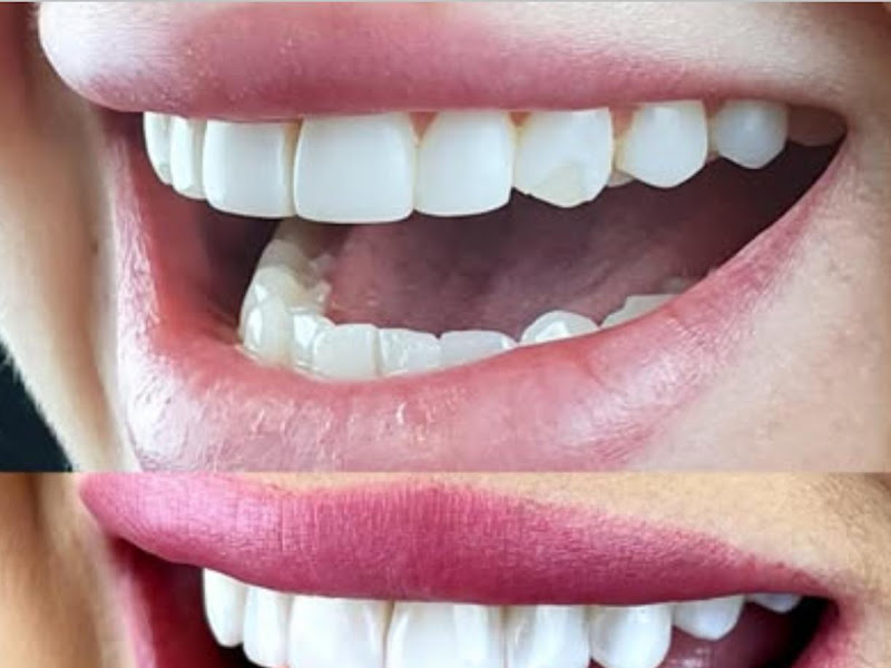 Foto 8 de Drª Shélen Fernandes Xavier - Consultório Odontológico