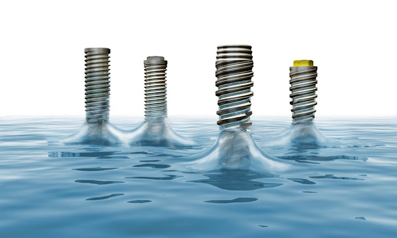 Foto 2 de Dr. Simon Cunha Implantes dentários