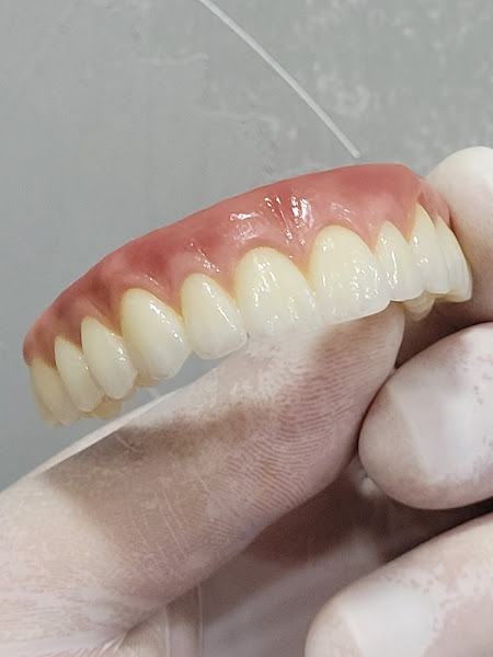 Foto 3 de Dr. Simon Cunha Implantes dentários