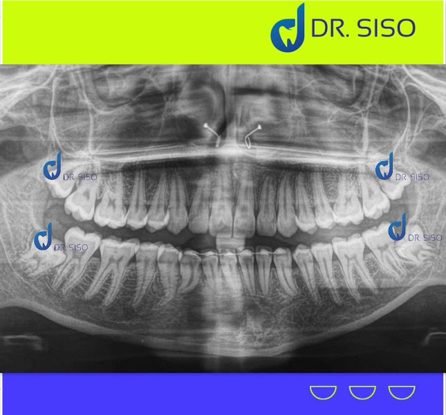 Foto 3 de Dr. SISO - CENTRO CIRÚRGICO ODONTOLÓGICO