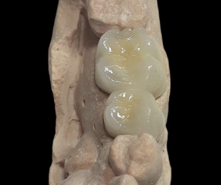 Foto 2 de Dr. Tácio Lyra - Cirurgião Bucomaxilo e Implante Dentário