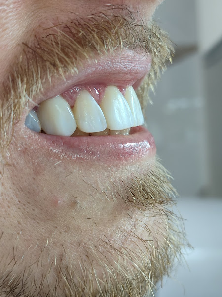 Foto 2 de Dr. Tácito Barros | Dentista em Santa Mônica Vila Velha