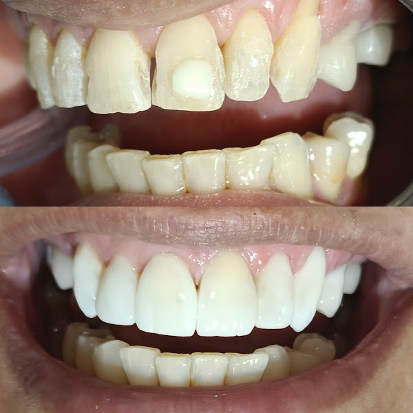 Foto 3 de Dr. Tácito Barros | Dentista em Santa Mônica Vila Velha