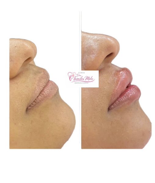 Foto 2 de Drª.Tamiles Melo Odontologia e Estética