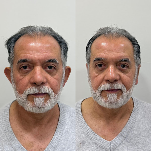 Foto 3 de Dr. Tarlei Fonseca, dentista especialista em fechamento de orelhas