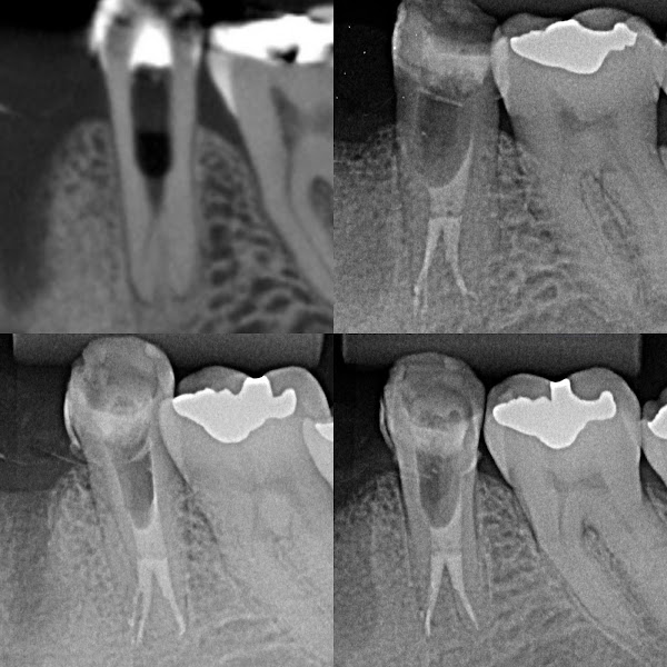 Foto 3 de Dr. Tarso Campos - Endodontista