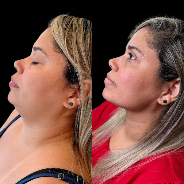 Foto 3 de Drª. Taynná Coelho