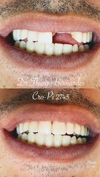 Foto 2 de Dr. Thiago Bernardes