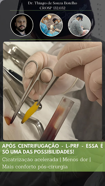 Foto 3 de Dr. Thiago Botelho - FaceVitalis dentista em Campinas