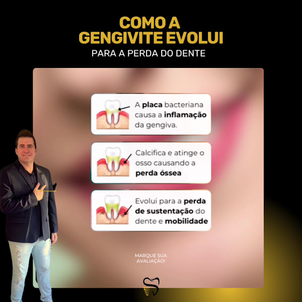 Foto 2 de Dr. Thiago de Souza Cruz e Equipe| Clínica de implantes e especialidades