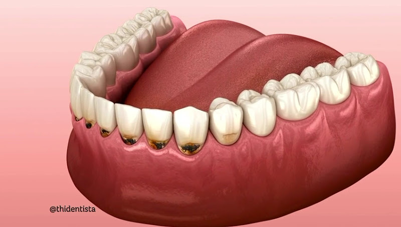 Foto 3 de Dr. Thiago de Souza Cruz e Equipe| Clínica de implantes e especialidades