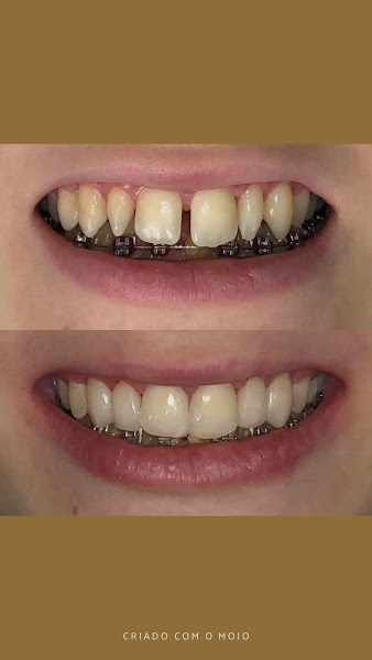 Foto 3 de Dr. Thiago Parra- Estética Dental
