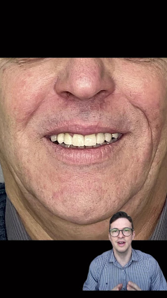 Foto 4 de Dr. Thiago Parra- Estética Dental