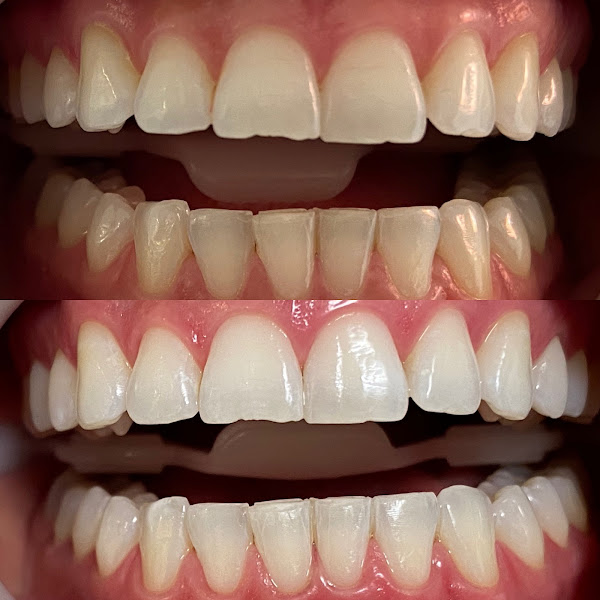 Foto 2 de Dr. Tiago Boaventura - Ortodontia