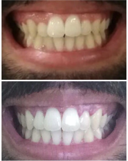 Foto 3 de Dr. Tiago Dantas, Dentista