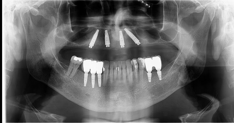 Foto 3 de Dr Tiago Keller
