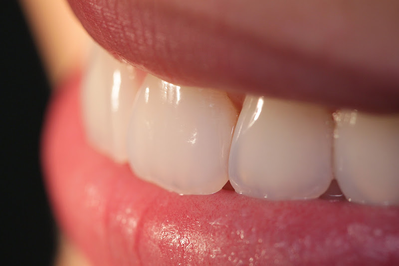 Foto 2 de Dr. Tiago Veras - Odontologia de alta performance